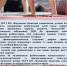 Медицинская реабилитация детей после хирургической коррекции - Центр инфекционных заболеваний и СПИД